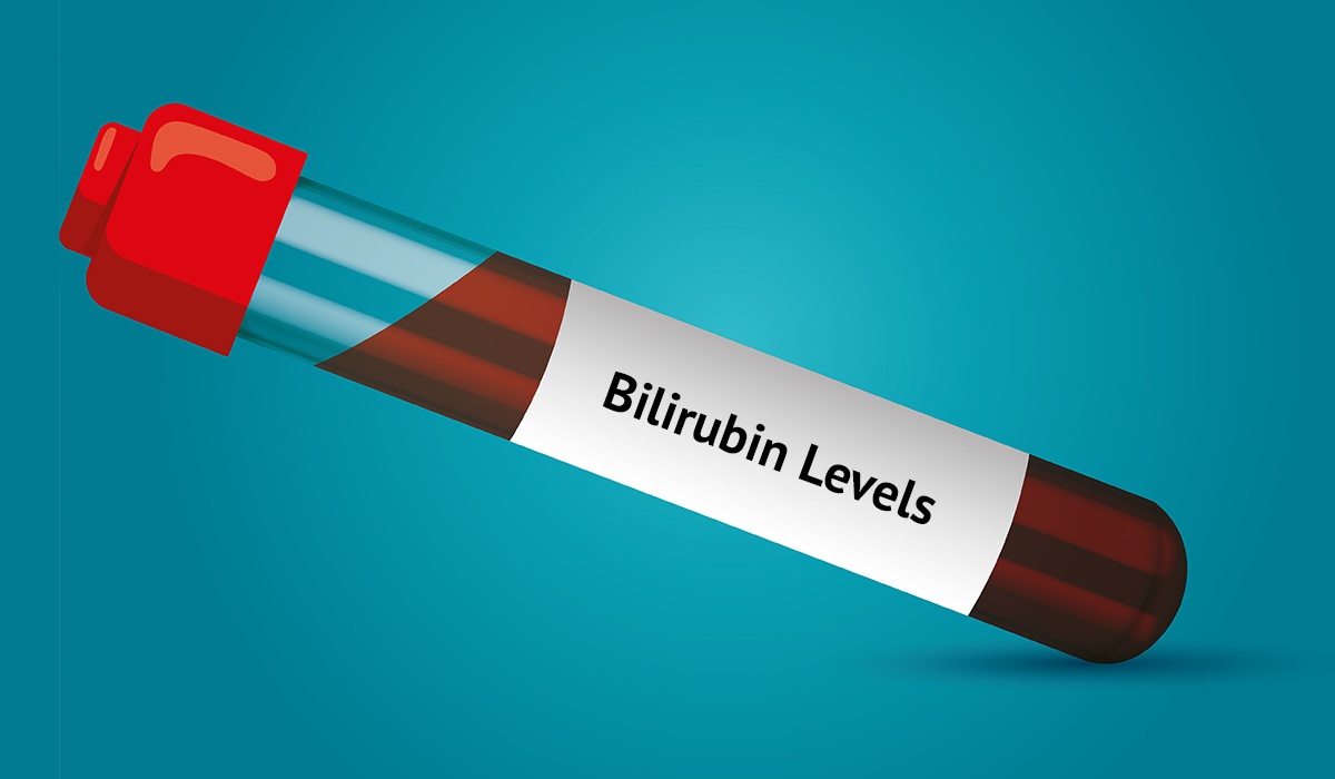 Bilirubin Levels: What Should Be The Normal Bilirubin Level ...